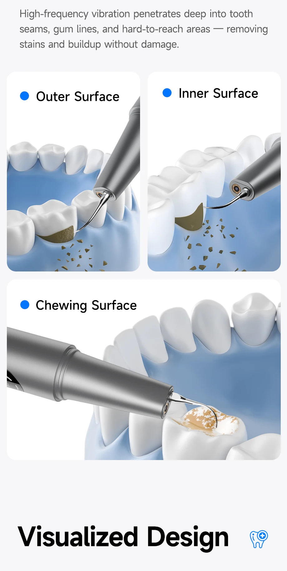 M1 Visible Electric Ultrasonic Teeth Cleaner with 500MP Camera Tartar Remover Coffe/Tobacco Stains Cleaning Teeth Whitening Tool