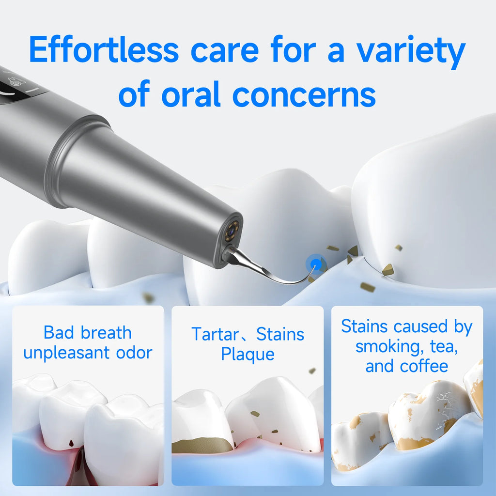M1 Visible Electric Ultrasonic Teeth Cleaner with 500MP Camera Tartar Remover Coffe/Tobacco Stains Cleaning Teeth Whitening Tool